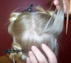 Head lice image 3